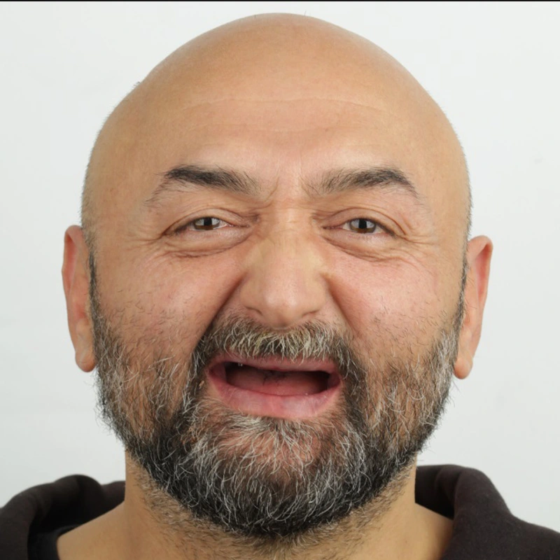 before-after-001-before