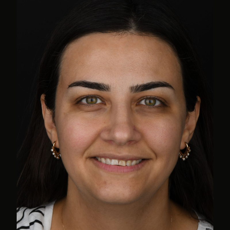 before-after-002-before