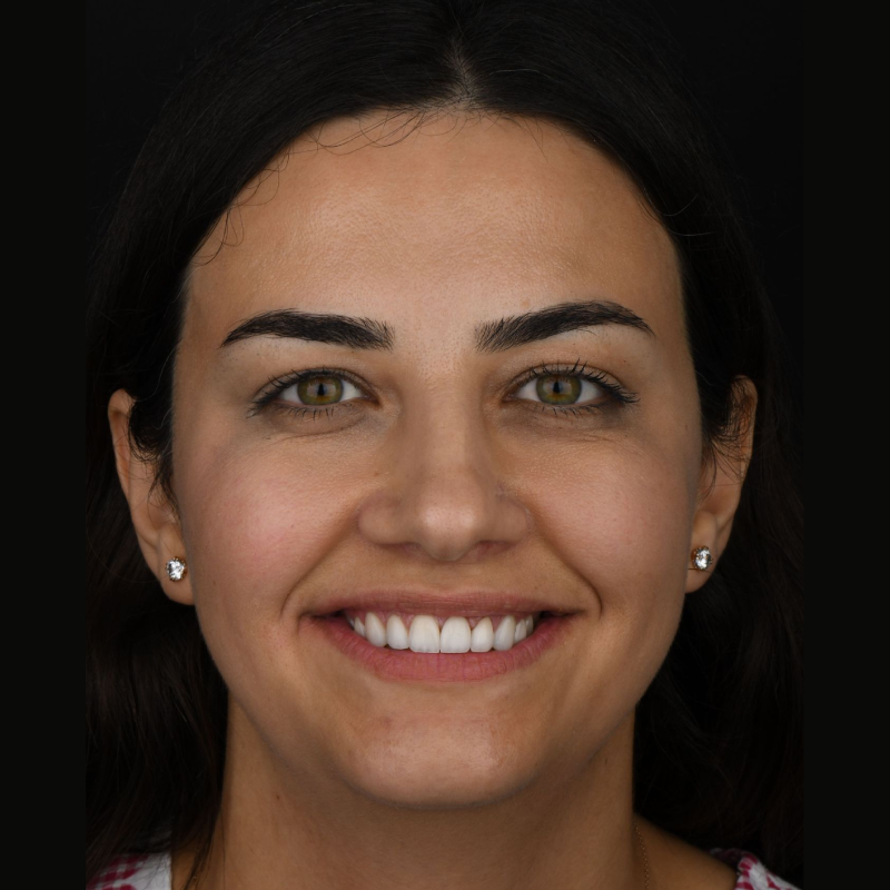 before-after-002-after