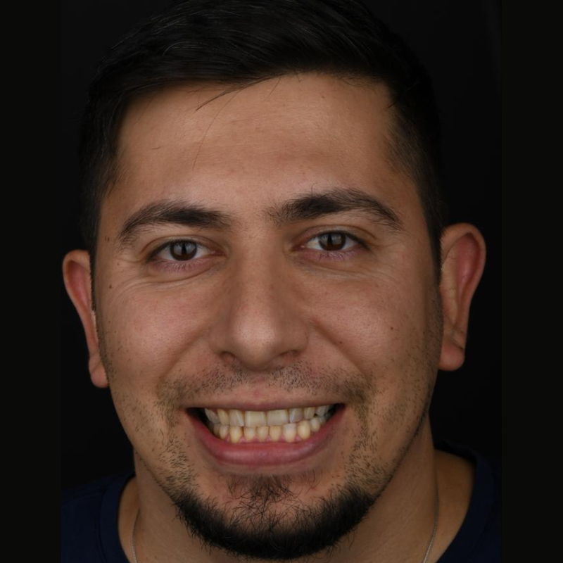 before-after-003-before