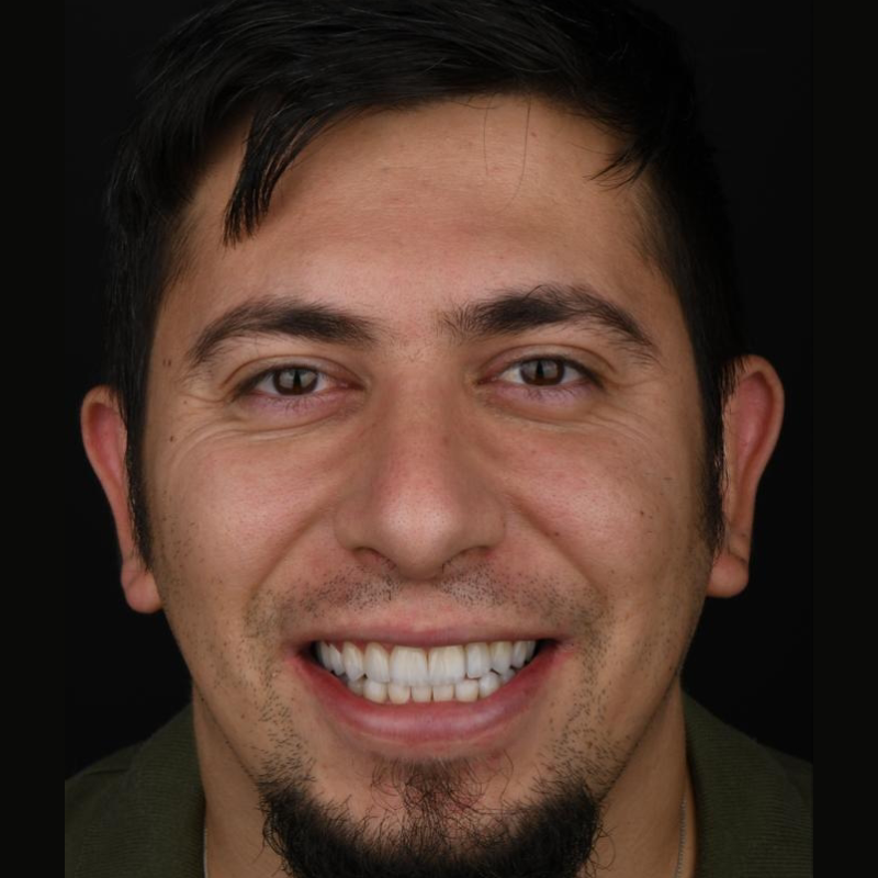 before-after-003-after