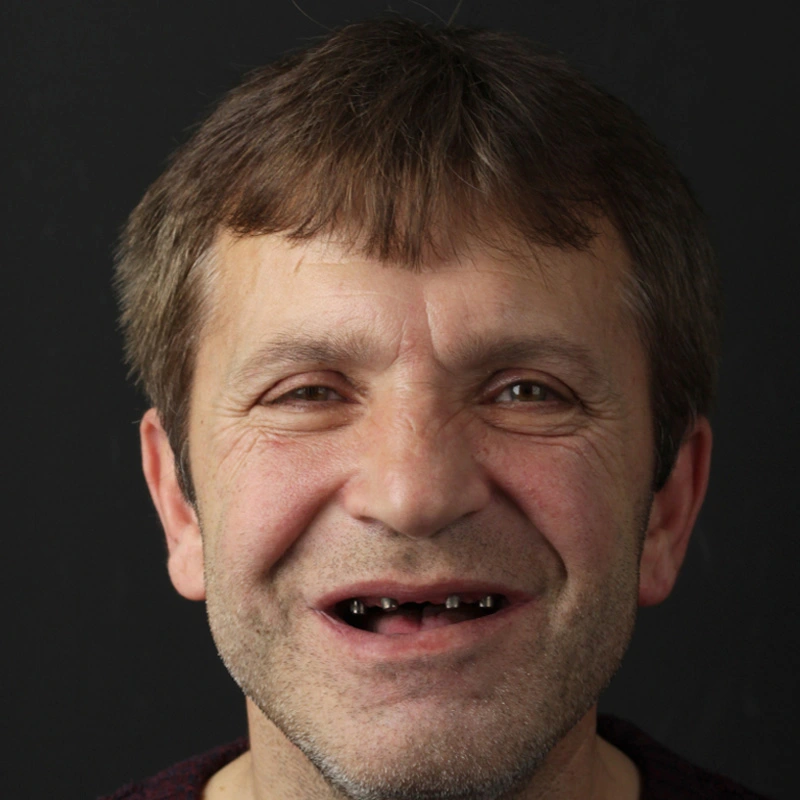 before-after-004-before