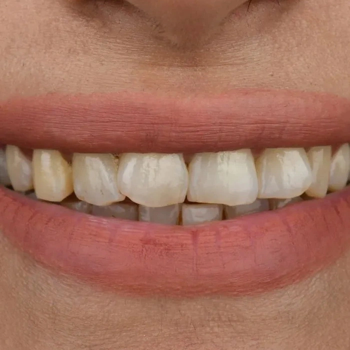 before-after-005-before