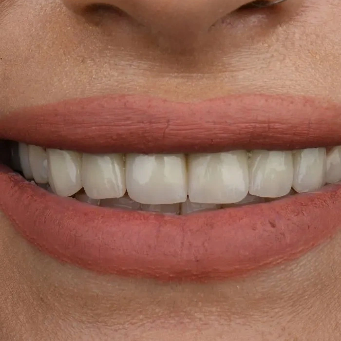 before-after-005-after