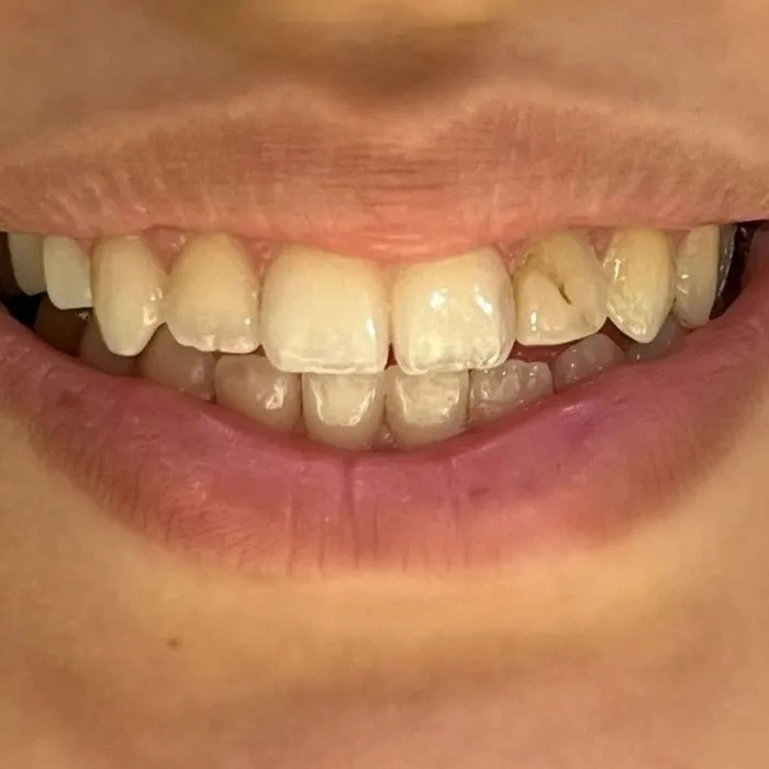 before-after-006-before