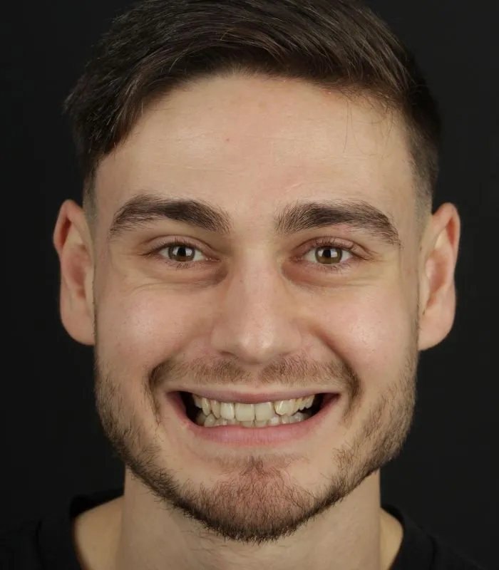 before-after-007-before