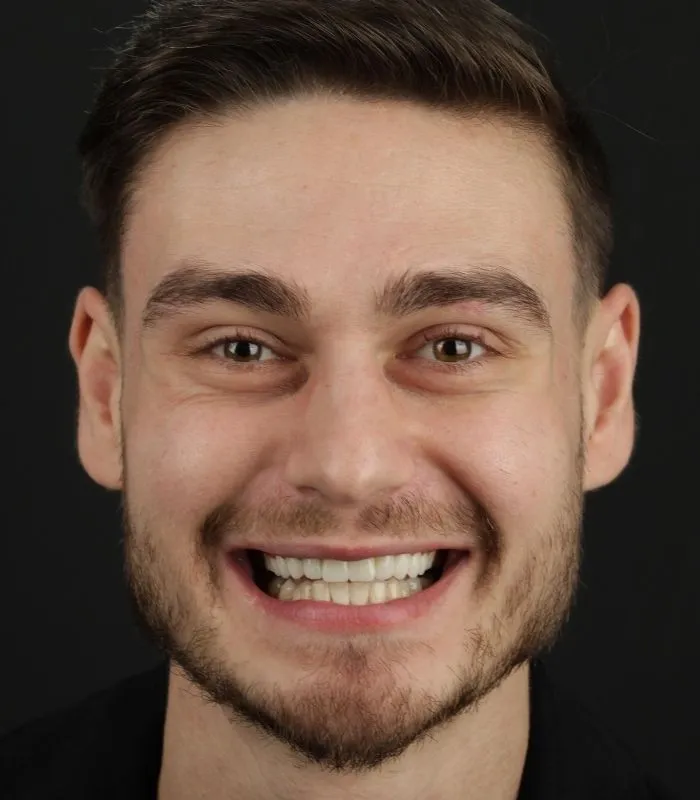 before-after-007-after