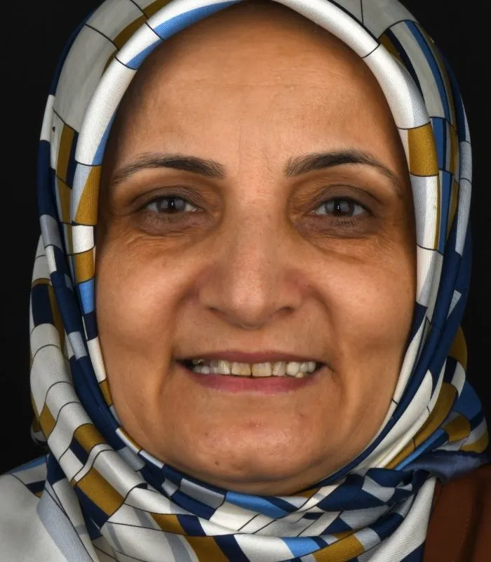 before-after-009-before