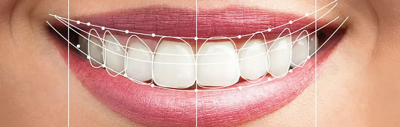 smile-2.webp
